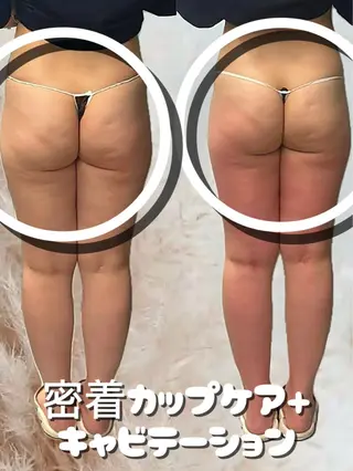 痩身・脱毛・肌管理 Rechica心斎橋のエステ・リラクイメージ