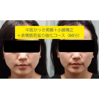中医気功経絡法 宮医堂のエステ・リラクイメージ