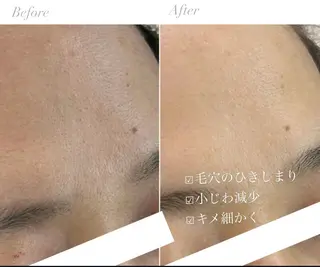 毛穴肌管理サロン ラクシュミーのエステ・リラクイメージ