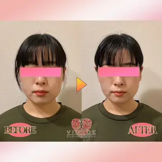 ヴィオーデ美容整体 サロン　錦糸町店のエステ・リラクイメージ