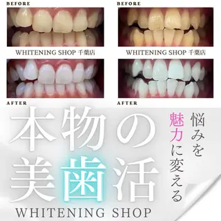 メンズ ホワイトニング ショップ千葉店のその他イメージ