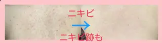 ハーブピーリング 専門店Kikkaのエステ・リラクイメージ