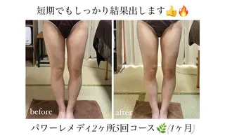 《本気痩せ×疲労改善 》  BILOOPのエステ・リラクイメージ