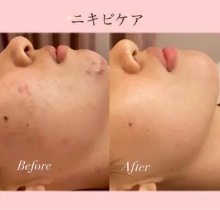 SAERA Misuzuのエステ・リラクイメージ