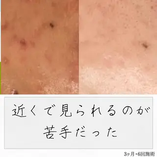 ニキビ経験者が施術 する専門サロン🌻のエステ・リラクイメージ