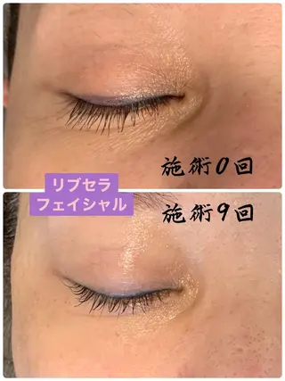プライベートサロン プリュネルのエステ・リラクイメージ