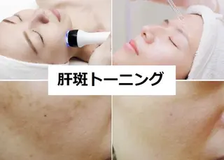 小顔&たるみ&美白 オンダ&痩身♪ヒロコのエステ・リラクイメージ