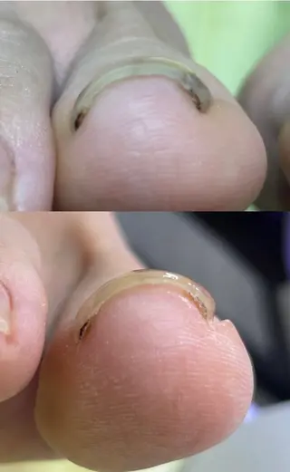 Free nail くるる府中のネイルデザイン