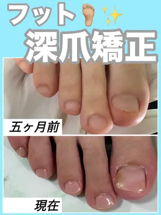 ネイル nail salon petillantのネイルデザイン