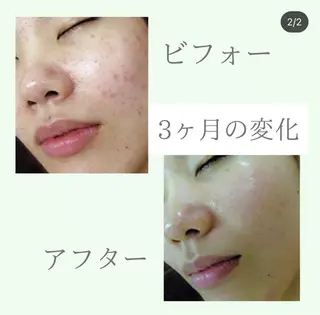 🎀BiBi韓国美容 コスパ強!美活サロンのエステ・リラクイメージ