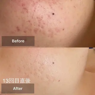 メンズ キッズ 美肌と癒しのサロン Lu,Mieのエステ・リラクイメージ
