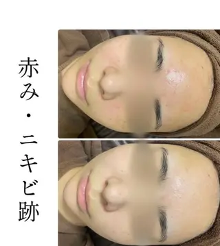 ハーブピーリング専門 BIOPLUS+川崎のエステ・リラクイメージ
