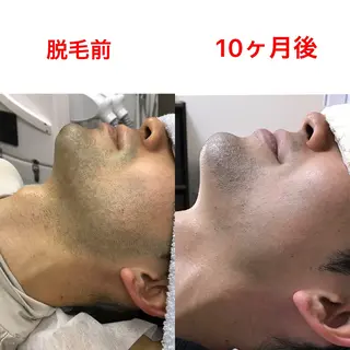 メンズ メンズ脱毛サロン ／金山昌弘のエステ・リラクイメージ