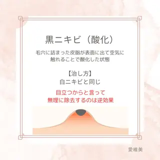 マツエク・マツパ 愛維美水光美肌専門店 メンズレディースokのエステ・リラクイメージ