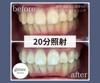 ネイル ホワイトニング専門店 glitterのその他イメージ