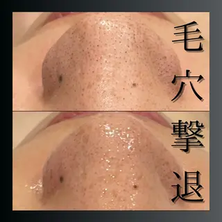 LiZA エステティックサロンのエステ・リラクイメージ