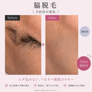 【美肌・脱毛専門店】 SARA 恵比寿店のエステ・リラクイメージ