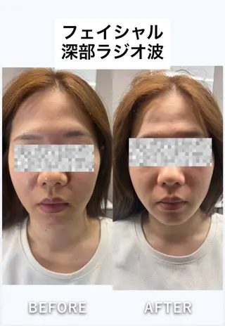 痩身・脱毛・肌管理 Rechica心斎橋のエステ・リラクイメージ