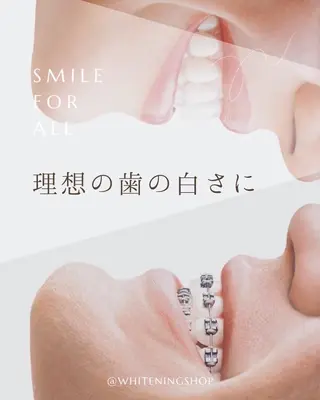 ホワイトニング ショップ船橋店のエステ・リラクイメージ