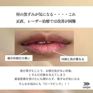 たるみほうれい線ケア 看護師サロンのエステ・リラクイメージ