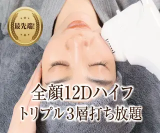 12Dハイフ💗 最強小顔のエステ・リラクイメージ