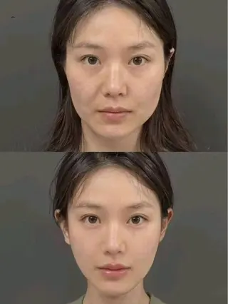 マツエク・マツパ 愛維美水光美肌専門店 メンズレディースokのエステ・リラクイメージ