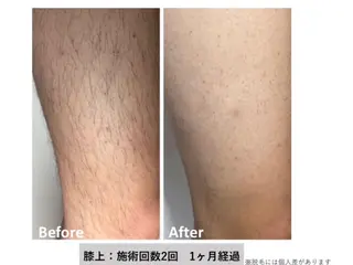 エステサロン さらのエステ・リラクイメージ