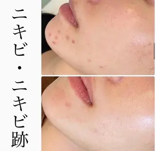 ハーブピーリング専門 BIOPLUS+川崎のエステ・リラクイメージ