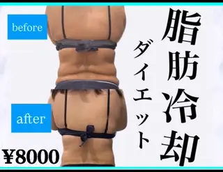 痩身ダイエット&小顔 🩷アールズスリムのエステ・リラクイメージ