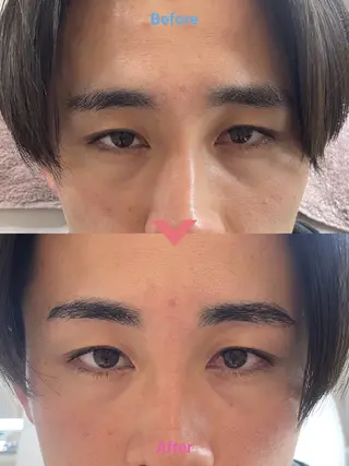 アイブロウ 🎀Luana🎀 トータルビューティーのエステ・リラクイメージ