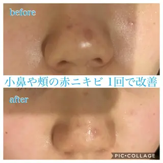 ロング カラー パーマ ヘアアレンジ キッズ ネイル マツエク・マツパ EnsorClair 代表 野口真央のエステ・リラクイメージ