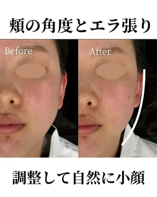 恵比寿/代官山 鍼灸師/根本亮佑のエステ・リラクイメージ
