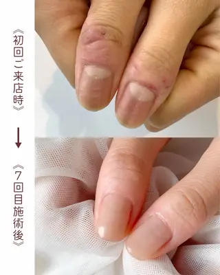 ネイル 山田 さやのネイルデザイン