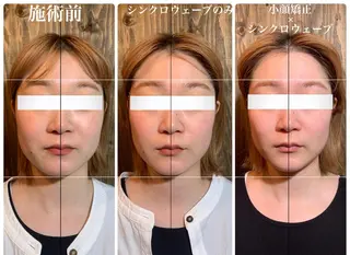 💎後悔させない小顔 矯正💎イトヤマ🌱のエステ・リラクイメージ