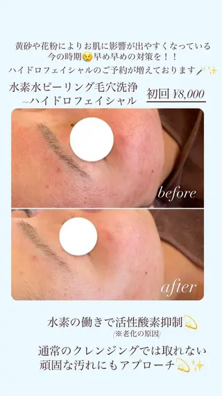【頭痛、睡眠改善】 salon RUUのエステ・リラクイメージ