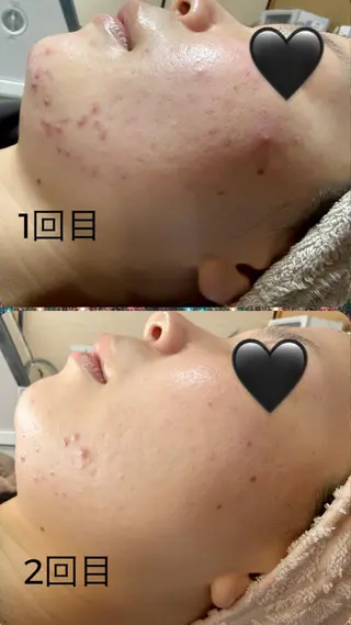 COCO beautyサロンのエステ・リラクイメージ