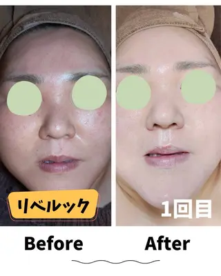 コンセプトサロン友 木下のエステ・リラクイメージ