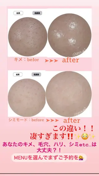 RION 〜リオン〜 / 肌育サロンのその他イメージ