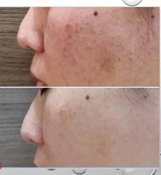 yourssalon LAUTのエステ・リラクイメージ