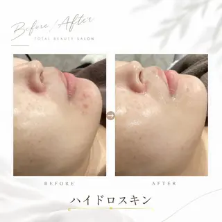 《 肌質×美肌 》 addissimoのエステ・リラクイメージ