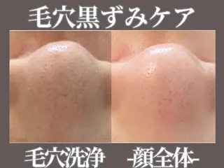 MavY.西葛西店 エステサロンのエステ・リラクイメージ