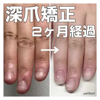 ネイル nail salon petillantのネイルデザイン
