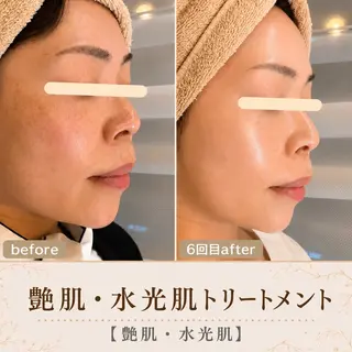 メンズ 最速小顔・肌管理 espoir 阿部のエステ・リラクイメージ