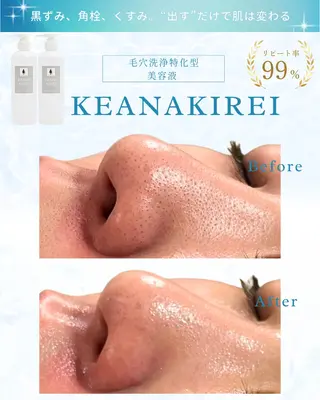 LiAm《美肌管理/ 小顔/脂肪ケア》のエステ・リラクイメージ