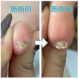 ネイル ネイルサロンエール 店長沼尻のネイルデザイン