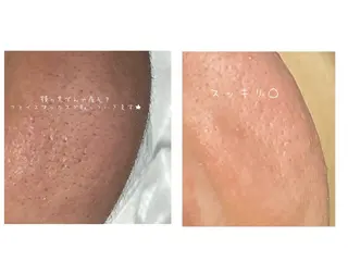 eclipse eyelashのマツエク・マツパデザイン