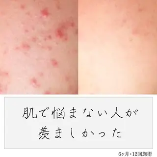 ニキビ経験者が施術 する専門サロン🌻のエステ・リラクイメージ