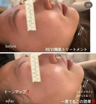 kana ハーブピーリング🌿のエステ・リラクイメージ