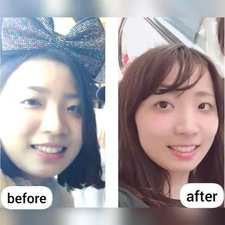 小顔&たるみアップ 専門店リラーシェのエステ・リラクイメージ