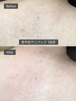 stella 柴山のエステ・リラクイメージ